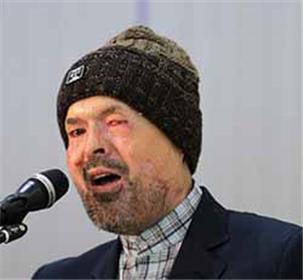 مدعیان دروغین حقوق بشر در قبال کشتار شیعیان افغانستان سکوت کرده‌اند